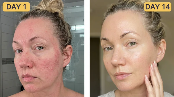 Elena R. before and after