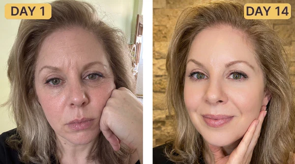 Sarah M. before and after