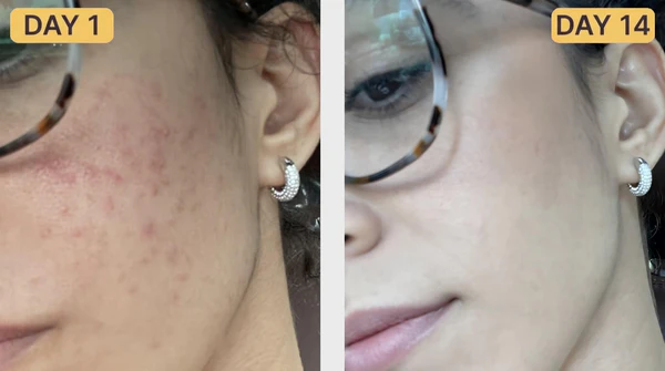 Amanda V. before and after